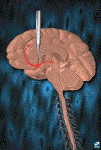Activation of the reward pathway